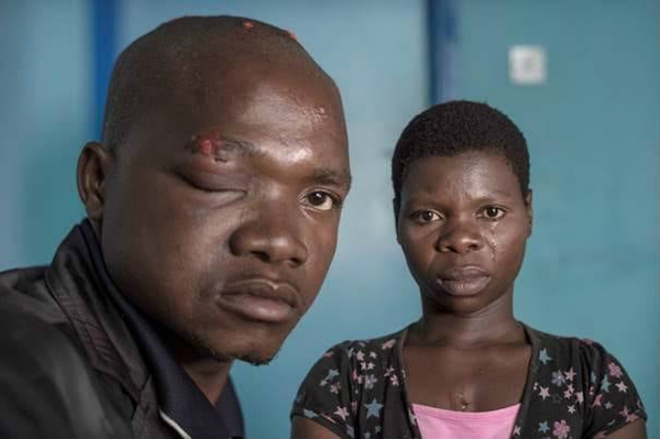 Un autre commerçant du marché de Blantyre, Alfred McJoe, 25 ans, et sa femme. Il a été agressé par un agent de police au commissariat local. Alfred vend des samoussas et a été arrêté puis libéré grâce à l'intervention du Centre for Human Rights Education Advice and Assistance (CHREAA). © Sven Torfinn / Panos, pour Open Society Foundations